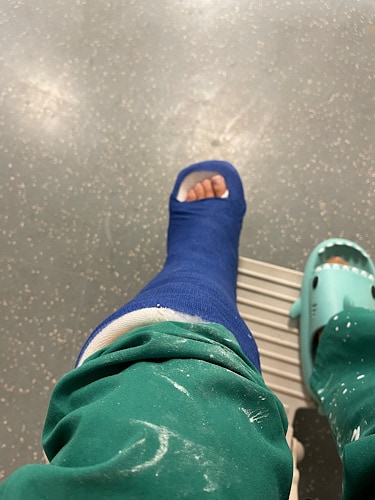 Linken Fuß in Gips